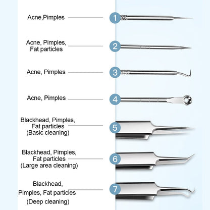 Blackhead Remover Tool Removal Extraction Stainless - Image 6